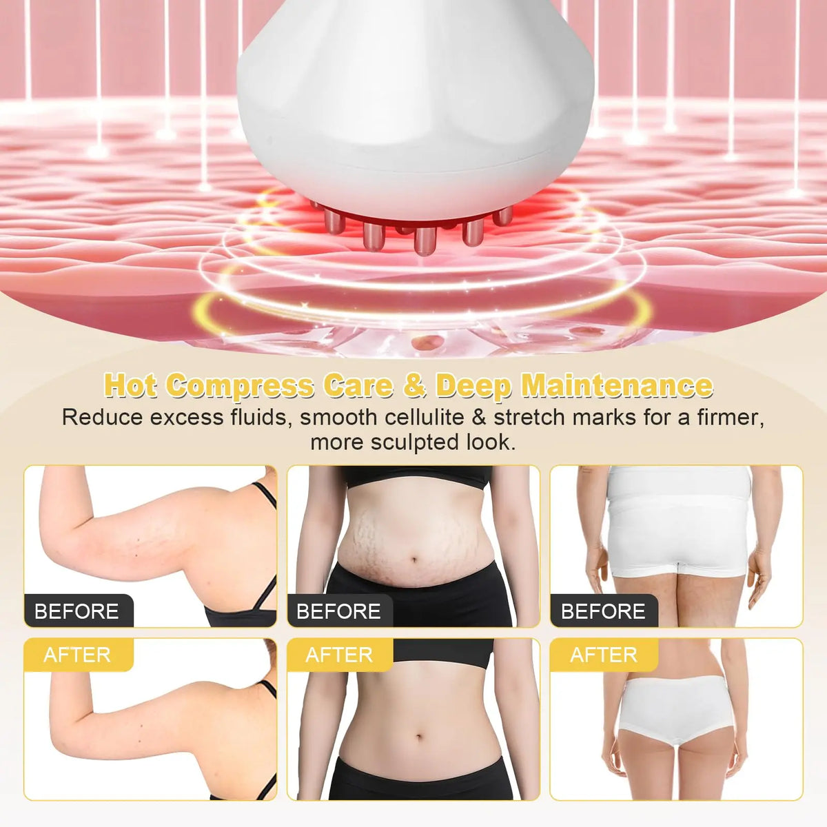 Jitesy Lymphatic Drainage Massager For Body Slimming And Sculpting