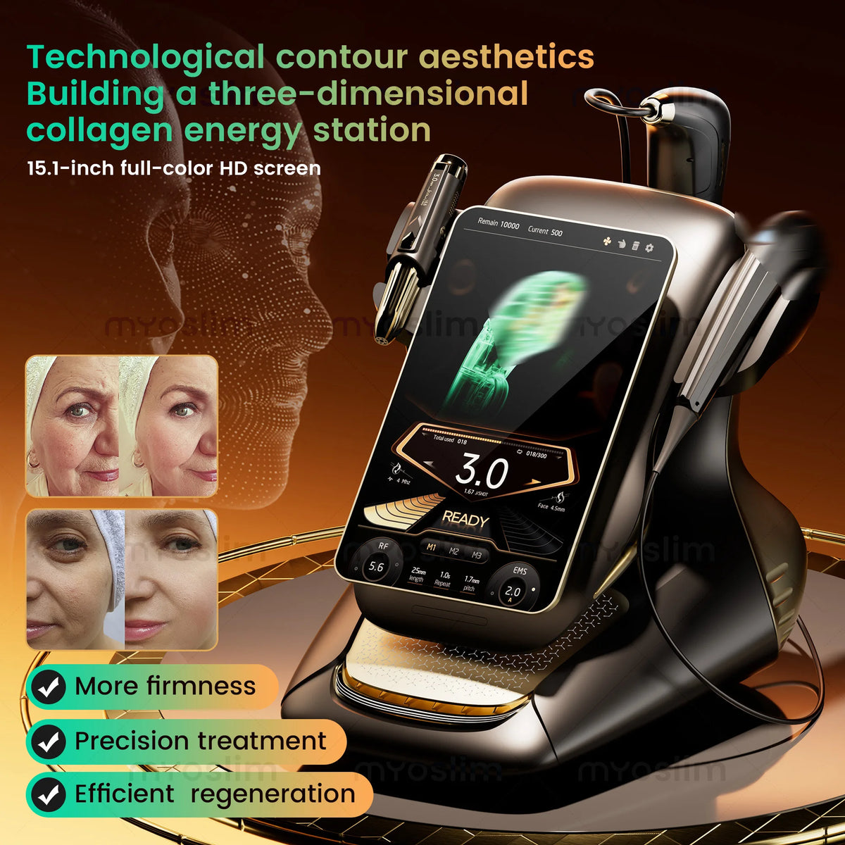 MYOSLIM Multifunctional HIF 25D Beauty Machine For Facial Tightening