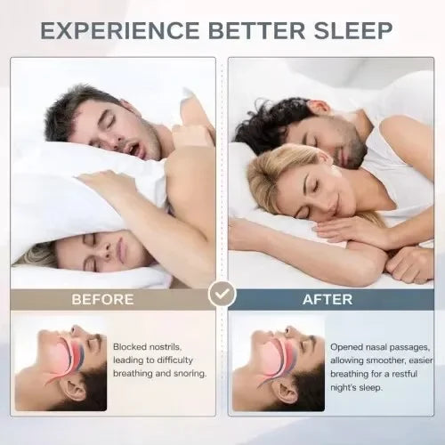 Nasal Dilator Strips for Snoring Relief and Nasal Congestion