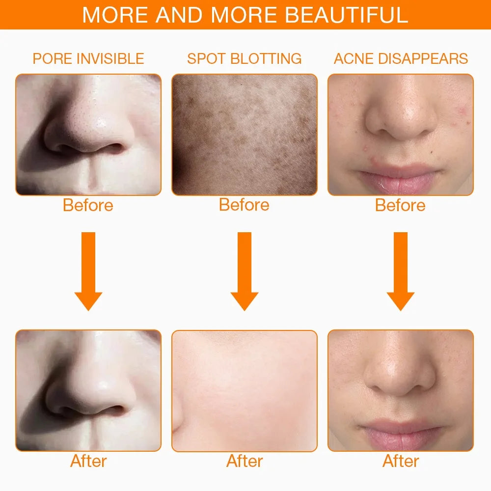 Iebilif LED Light Therapy Facial Mask For Advanced Skin Care